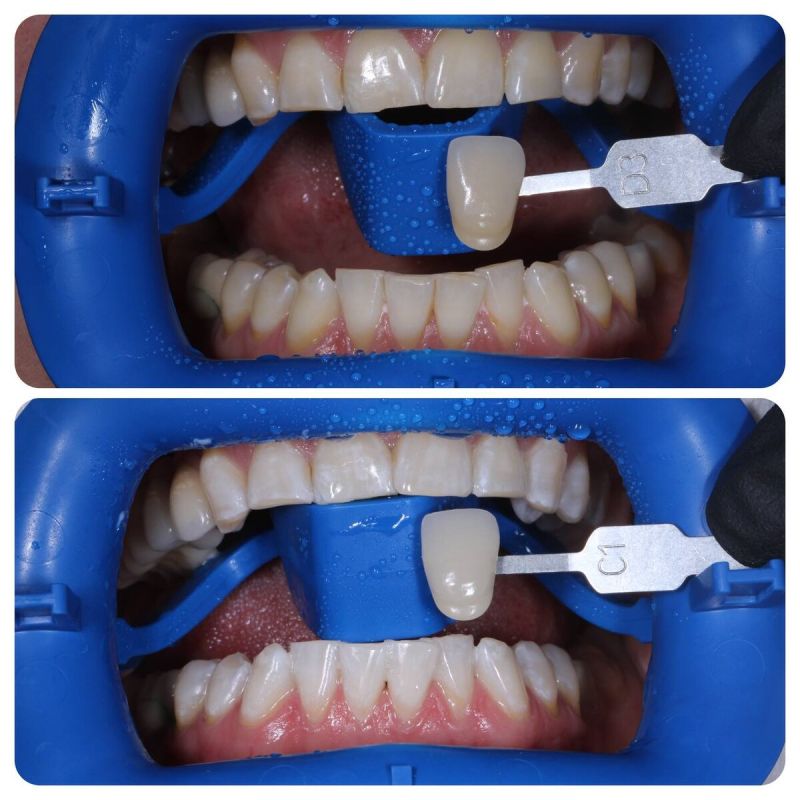 ��� ������� ��������� �� ������ � �������