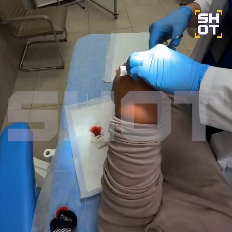 Восемь личинок достали из россиянки после отдыха во Вьетнаме Восемь личинок достали из россиянки после отдыха во Вьетнаме
