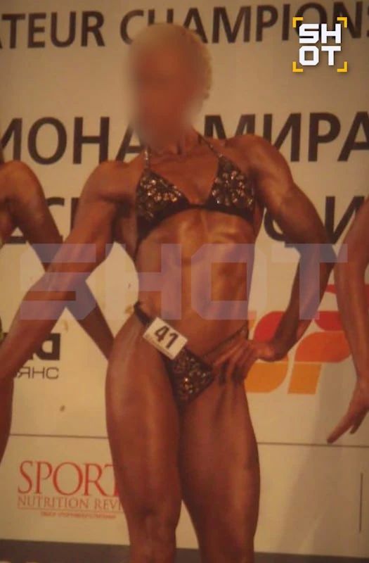 51-летняя бодибилдерша потеряла сознание во время увеличения груди в Москве