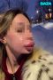 Москвичка не могла принять свою внешность и десятки раз увеличивала губы — а когда решила уменьшить, они стали больше вопреки