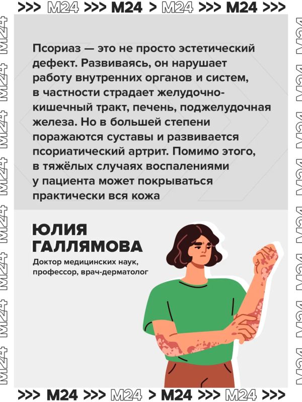 Псориаз может приводить к поражению кожи практически на всем теле, а также к развитию псориатического артрита Псориаз может приводить к поражению кожи практически на всем теле, а также к развитию псориатического артрита