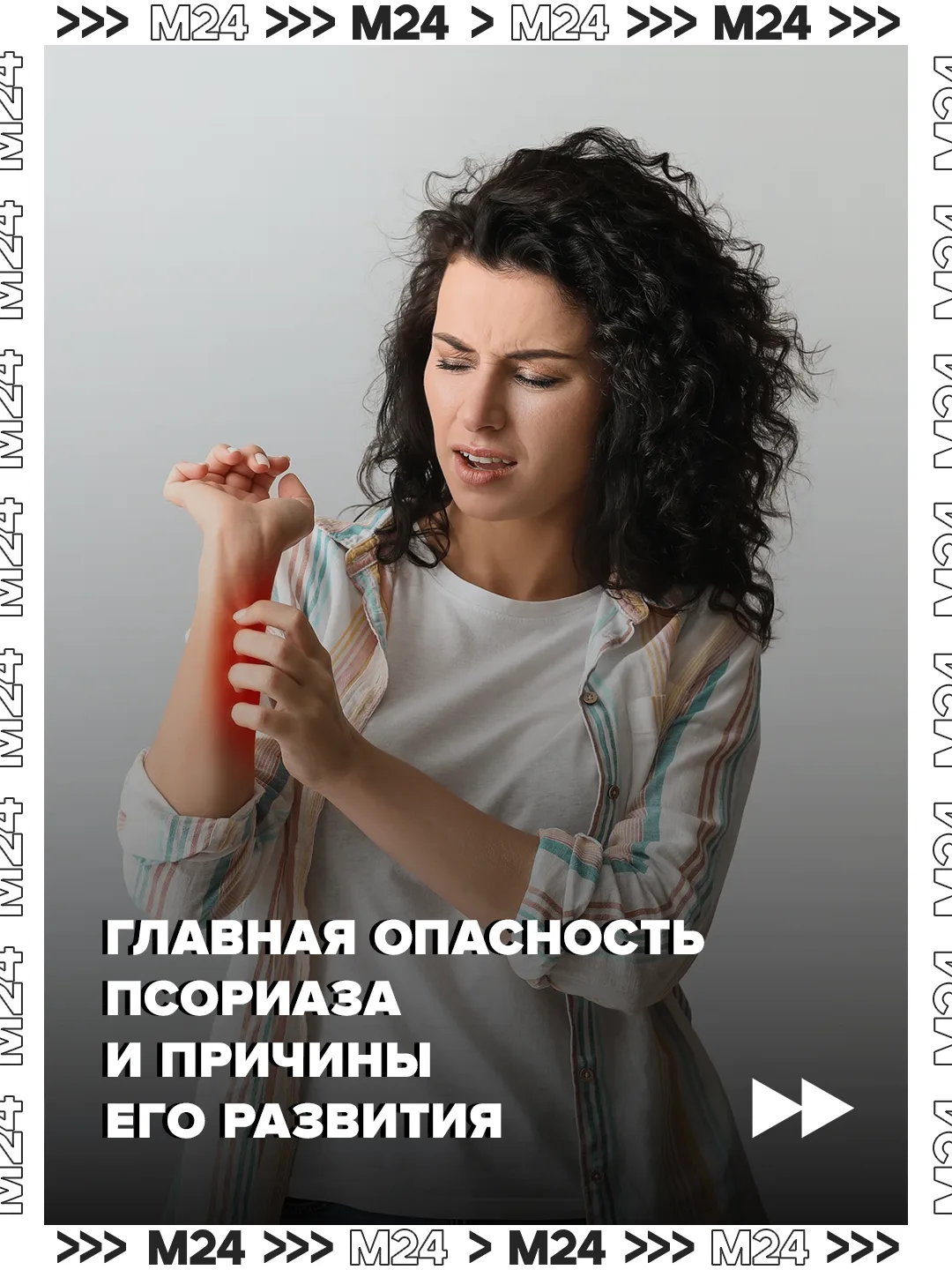 Псориаз может приводить к поражению кожи практически на всем теле, а также к развитию псориатического артрита